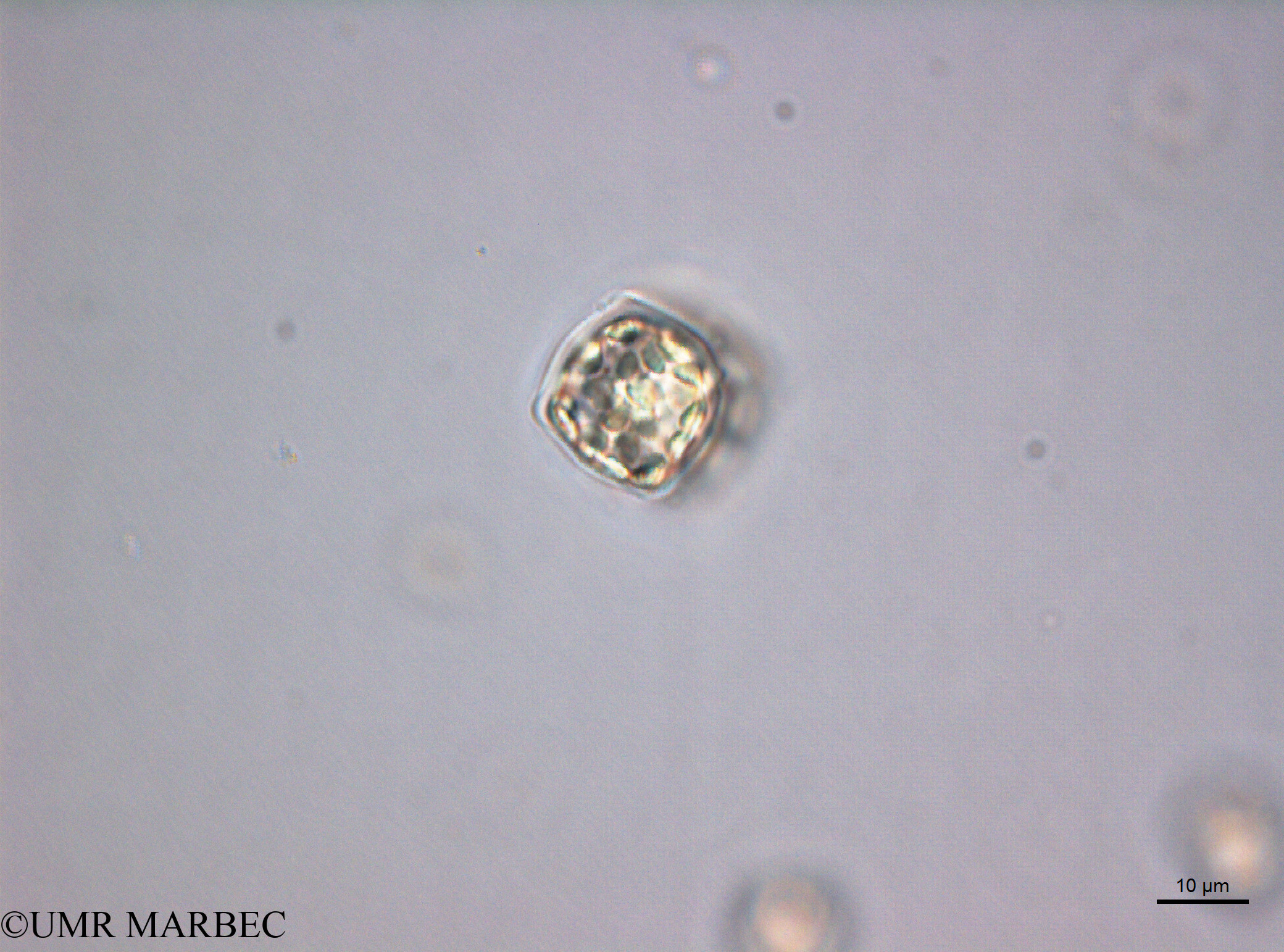 phyto/Scattered_Islands/juan_de_nova/COMMA2 November 2013/Cerataulina sp1 (D5_2_diatomee_ancien_melosira180717_001_ovl-30)(copy).jpg
